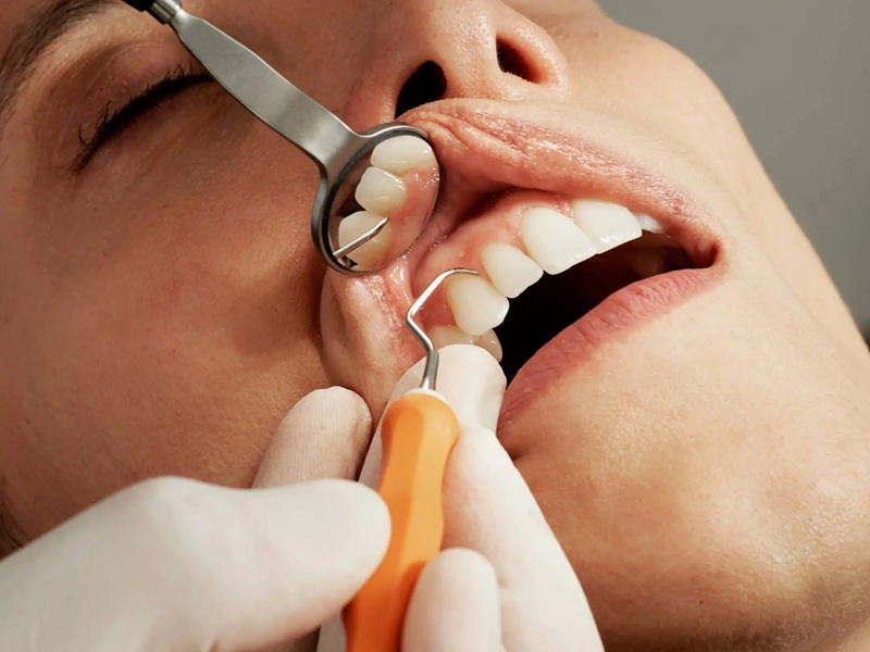 Igiene e Prevenzione Dentale udine